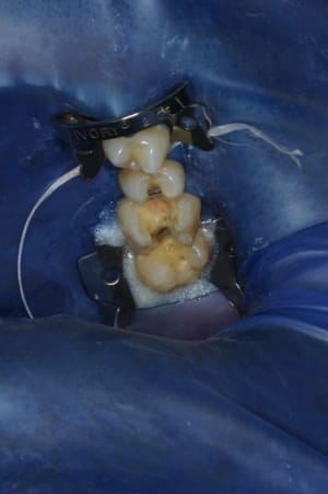 Img 1847 i8dz12 - Eugenol