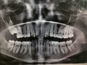 Img 1853 1  qgyupr - Eugenol
