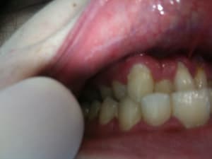 Img 1856 1  hiishm - Eugenol