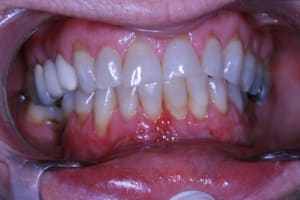 Img 1994 zzpfuk - Eugenol