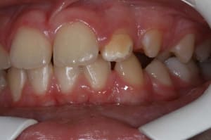 Img 1 vuyxp7 - Eugenol