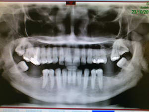Img 20121023 113927 psrkzz - Eugenol