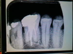 Img 20121106 094123 cadpsl - Eugenol