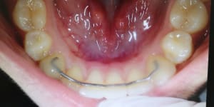 Img 20190222 112355 et6adz - Eugenol