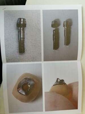 Img 20200311 105823 jezm6v - Eugenol