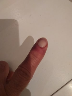 Img 20200327 193640 klfsqe - Eugenol