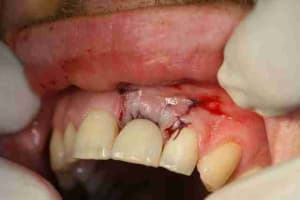 Img 2037 pjgqe3 - Eugenol
