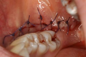Img 2075 oguubn - Eugenol