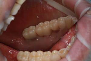 Img 2120 prcrab - Eugenol