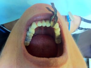 Img 2246 jcnzcm - Eugenol