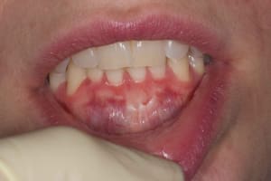 Img 2256 b3nga4 - Eugenol