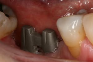 Img 2389 nz5wry - Eugenol