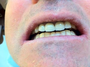 Img 2407 phnlp4 - Eugenol