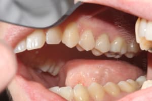 Img 2419 n1vxmq - Eugenol