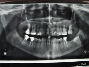 Img 2475 o0gz6f - Eugenol