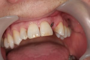 Img 2633 mtraaa - Eugenol