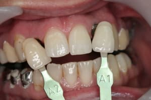 Img 2639 xvttp7 - Eugenol