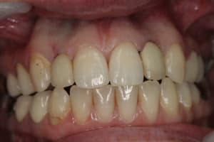 Img 2658 zp6y1q - Eugenol