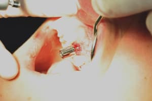 Img 2672 ek1yng - Eugenol