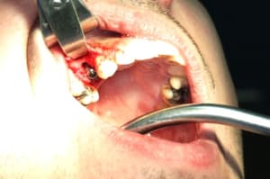 Img 2765 dx6vvw - Eugenol