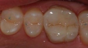 Img 2766 ki58hi - Eugenol
