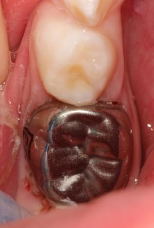 Img 2807 mmhlbr - Eugenol