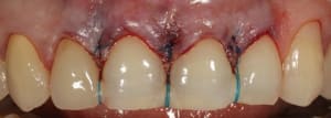 Img 3214 zo4wco - Eugenol