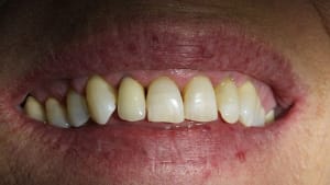 Img 3292 y8femf - Eugenol