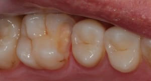 Img 3539 iw0jhx - Eugenol