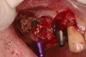 Img 3599  1024x768  epytym - Eugenol