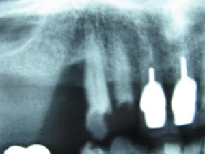 Img 3609 vfxreo - Eugenol