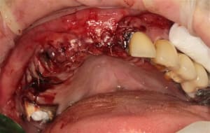 Img 3807 fyzfld - Eugenol