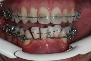 Img 3 q6xqga - Eugenol