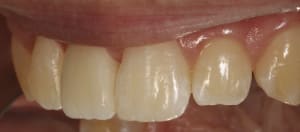 Img 4444 ebrgmj - Eugenol