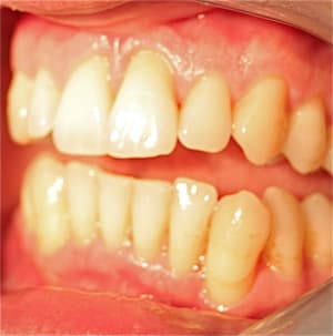 Img 4504 lig5nt - Eugenol