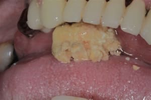 Img 4626 ptxkkd - Eugenol