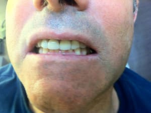 Img 4717 smn5hf - Eugenol