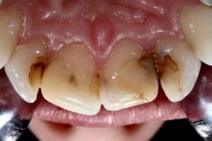 Img 4754 custom mx2iiv - Eugenol