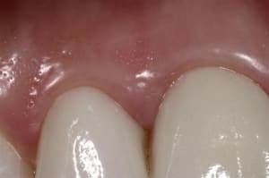 Img 4881 custom cbeipn - Eugenol