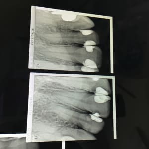 Img 5495 fkylhc - Eugenol