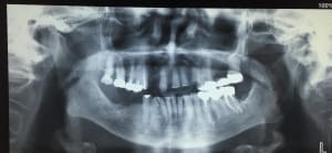 Img 5601 bwdnca - Eugenol