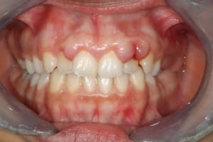 Img 5609 tgwmqs - Eugenol