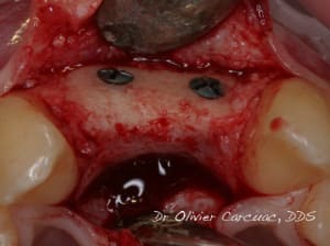 Img 5649 1  fn53ne - Eugenol