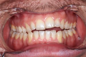 Img 5804 h2na9o - Eugenol