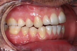 Img 5805 ofbnsu - Eugenol