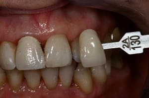 Img 5864  medium  edukri - Eugenol