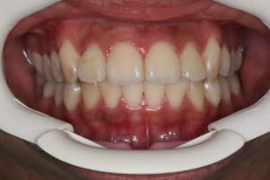 Img 5 gpdjde - Eugenol