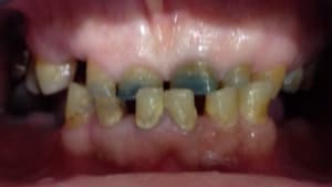 Img 6170 krimls - Eugenol