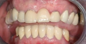 Img 6331 wpbrch - Eugenol