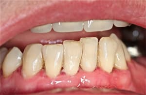 Img 6759 px2pmo - Eugenol